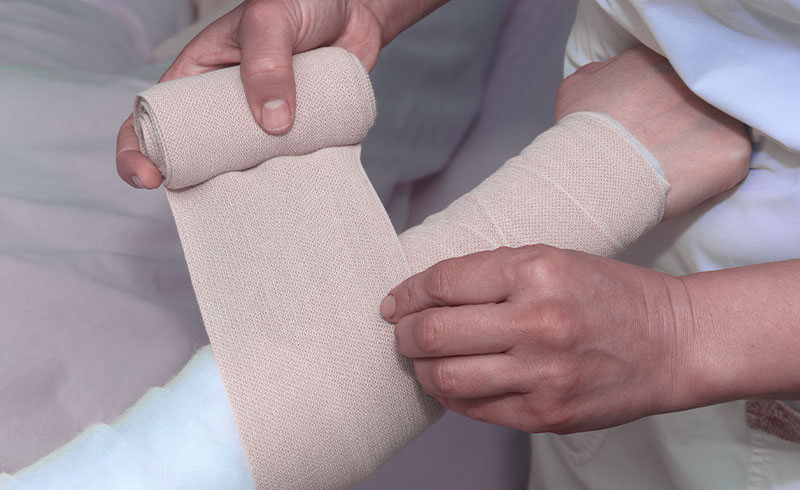 Behandlung des Lymphödems: Hand und Arm werden mit mehrschichtigen Verbänden zur Kontrolle von Lymphödem versehen.